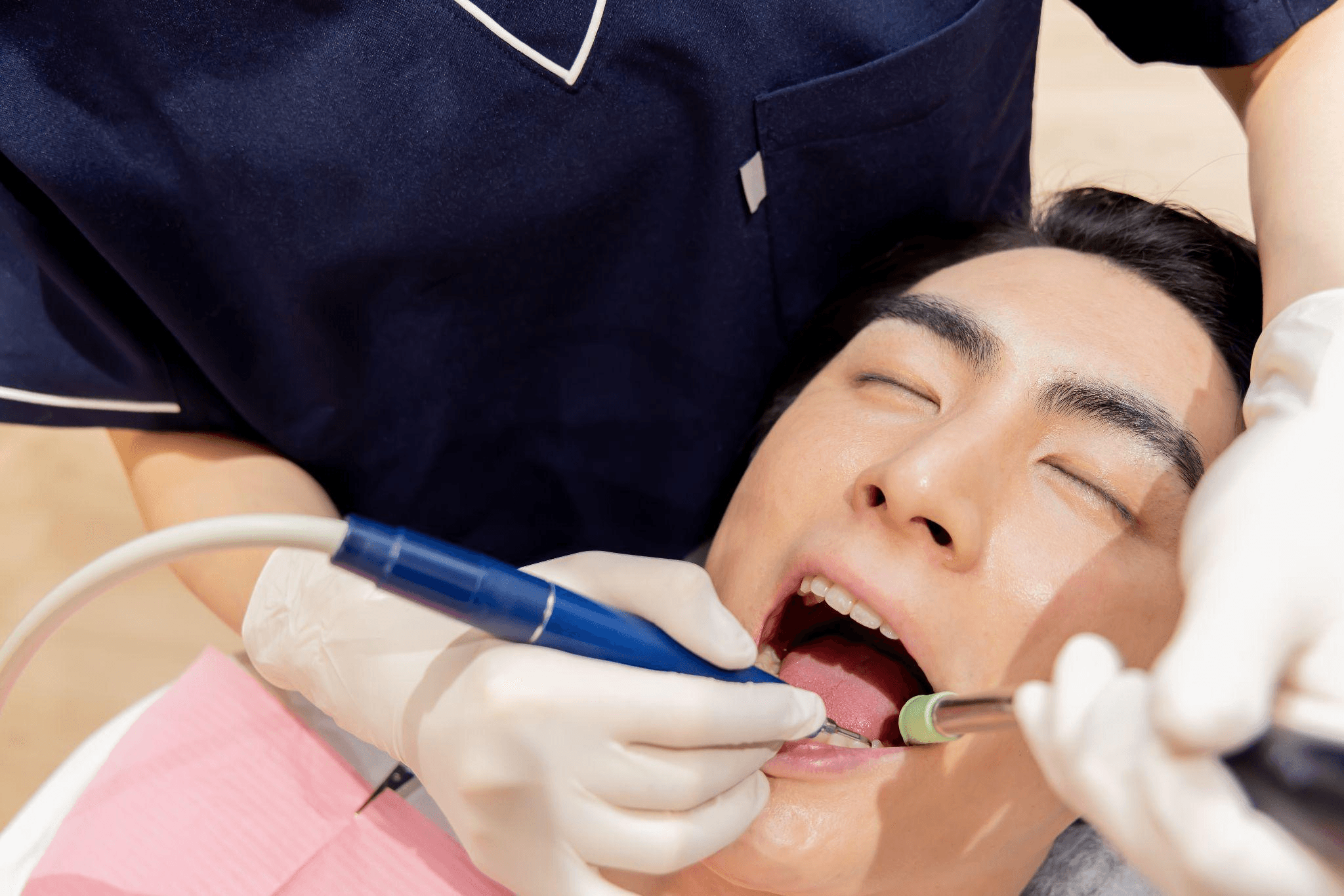 クリーニングで行われる処置の内容　