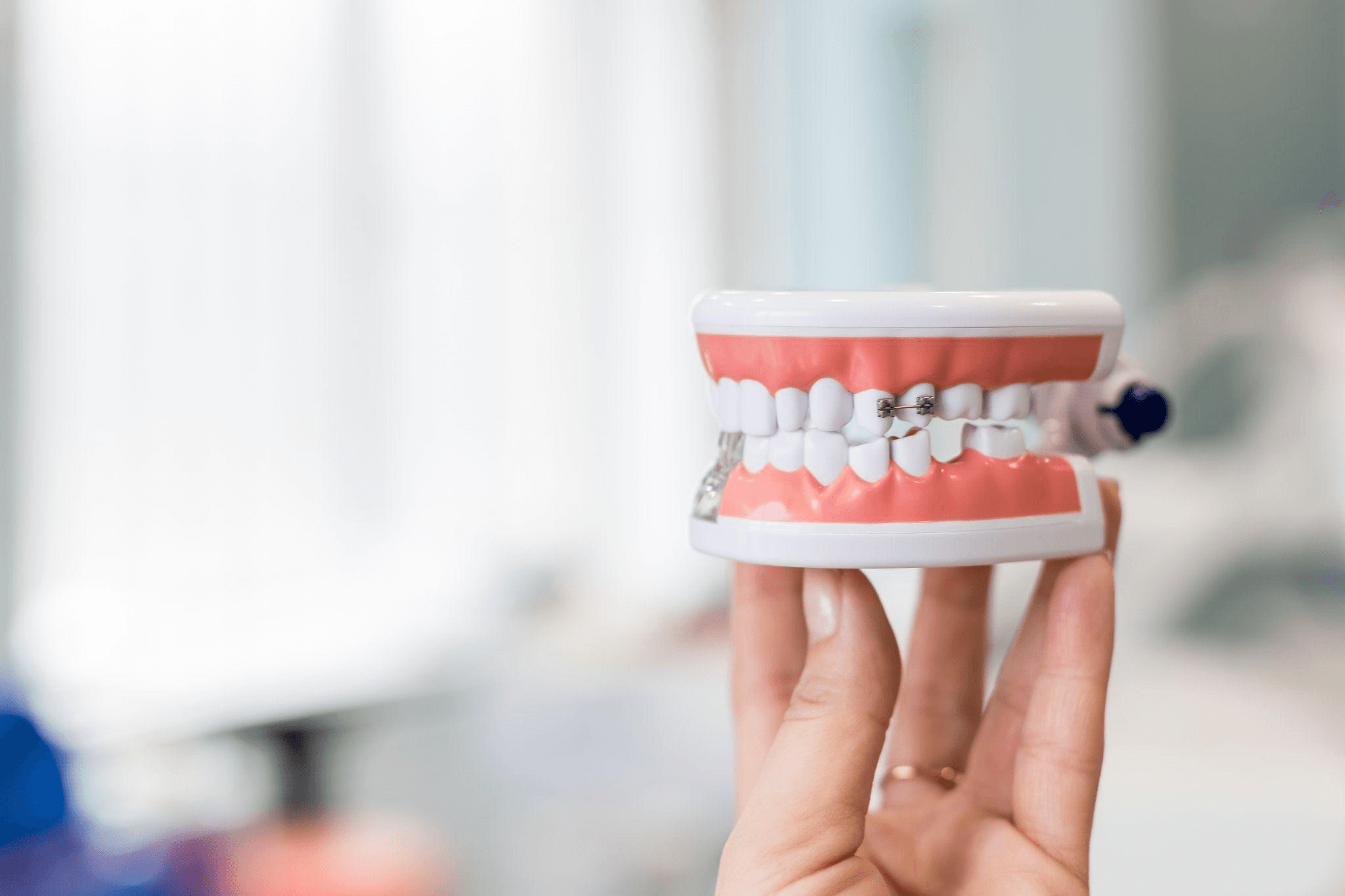 噛み合わせの矯正にかかる費用の目安